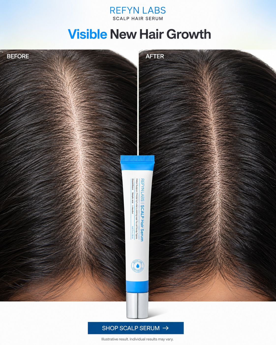 REFYN LABS™ SCALP Hair Serum